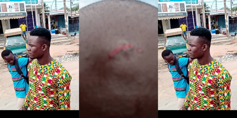 Okada rider bites forehead of taskforce officer over social distancing argument