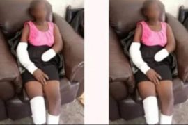 Boyfriend chops off 16-year-old girlfriend’s hand for rejecting marriage proposal